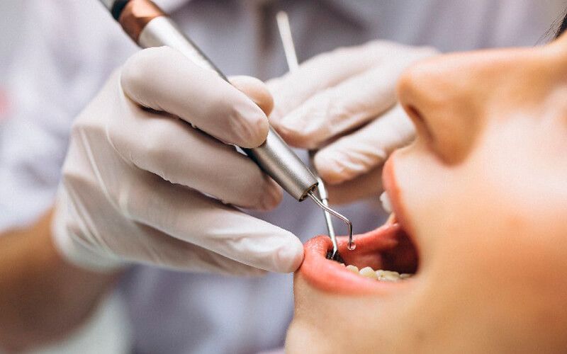 Teeth Whitening